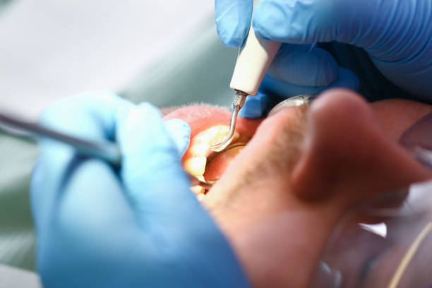 Best Emergency Treatment for Jaw Pain or Injury in San Antonio Heights, CA