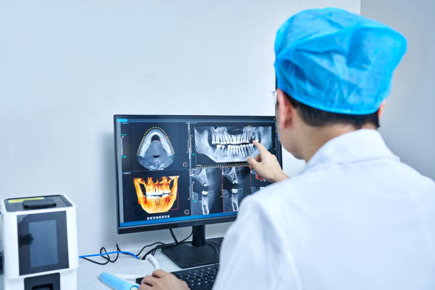 Best Emergency Treatment for Oral Infections in San Antonio Heights, CA